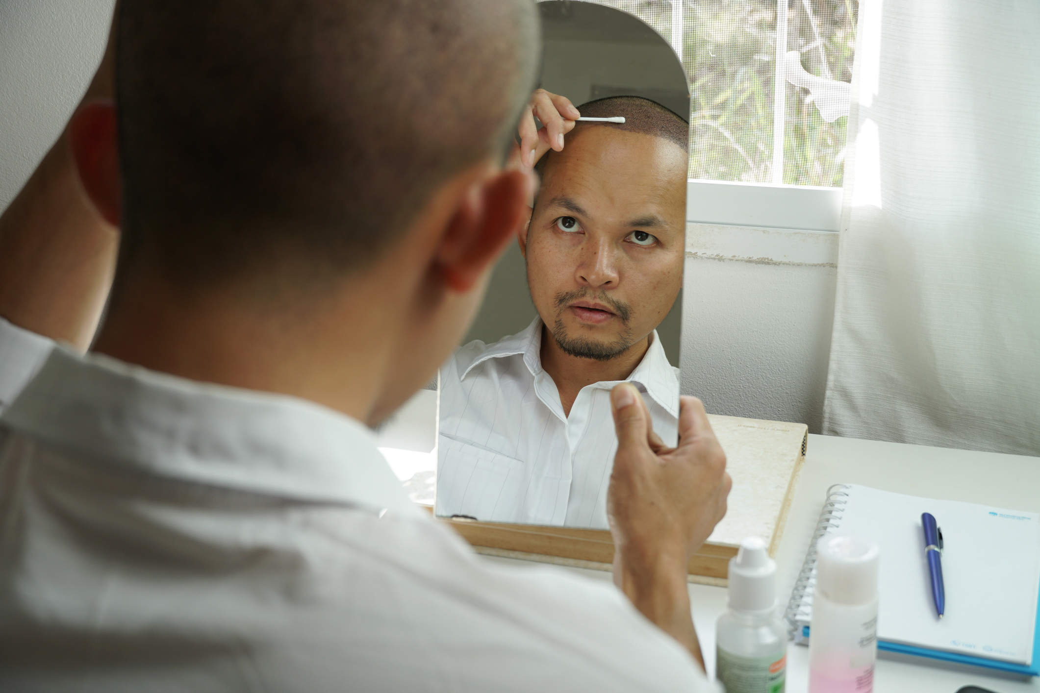 Top Hair Loss Treatments for Men, Backed by Science
